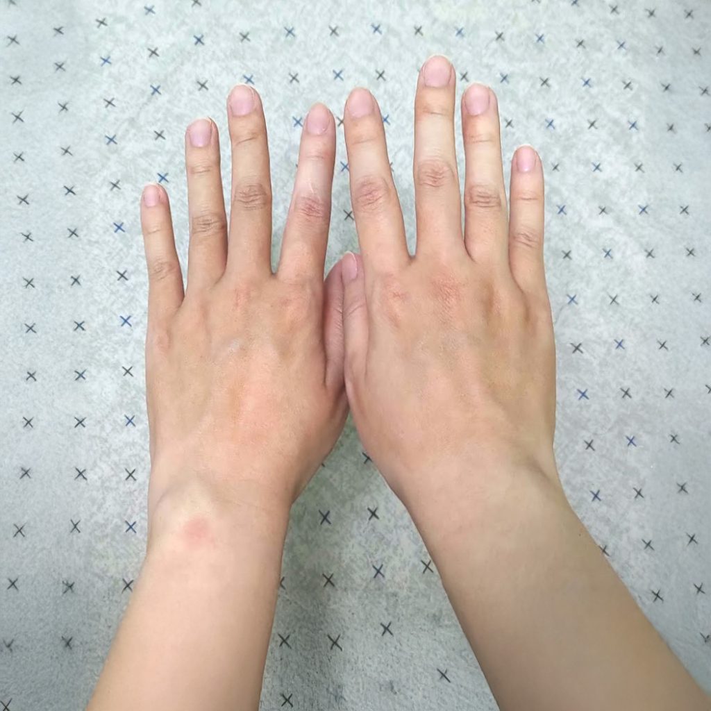 Ulike超光炮美容儀開箱實測心得：美白淡斑真的有效嗎？